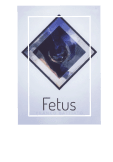 maglietta fetus 